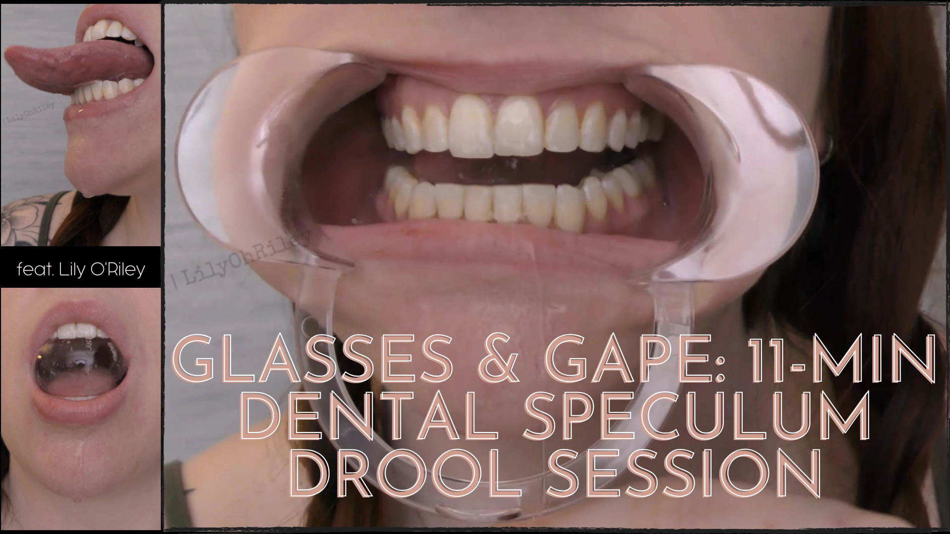 Glasses & Gape: 11-min Dental Speculum-Stretched Drool Session